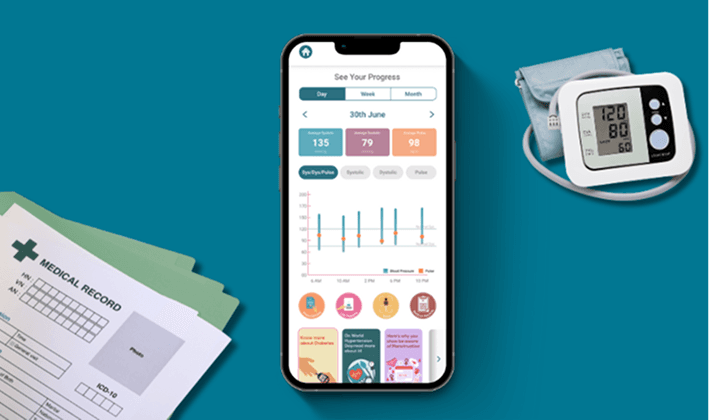 See changes over time