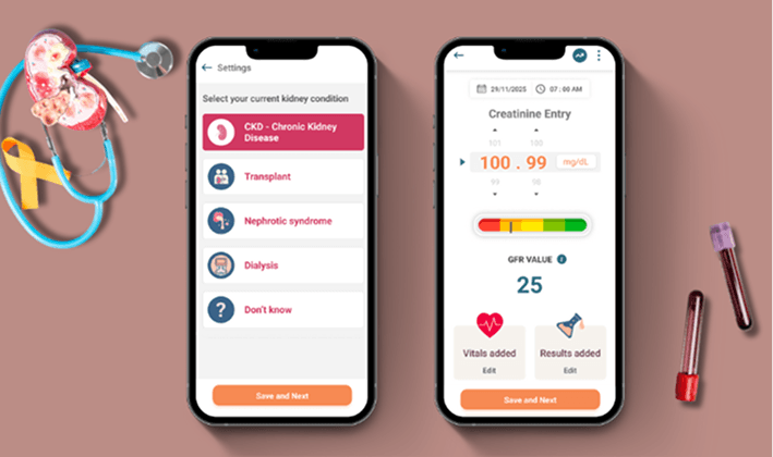 Keep an eye on changes